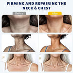 🏆Flash Sale⚡MAGEC Collagen Fullerene Neck Cream – Elevate Your Neck Care Routine ✨